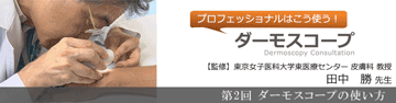 第2回　ダーモスコープの使い方