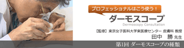 プロフェッショナルはこう使う！ダーモスコープ 「第1回 ダーモスコープの種類」