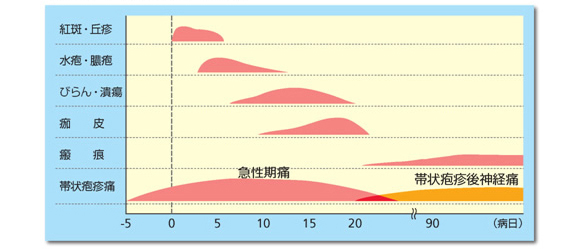 出典：新村眞人；感染・炎症・免疫, 31(4), 295(2001)より一部改変