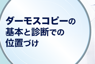 ダーモスコピーの基本と診断での位置づけ