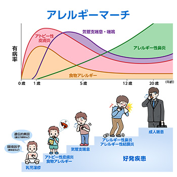 アレルギーマーチ