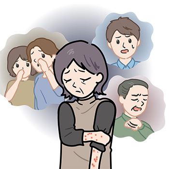 結節性痒疹-周囲には理解されなくて精神的に不安になっている