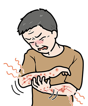 結節性痒疹-患部を掻きむしる壮年男性