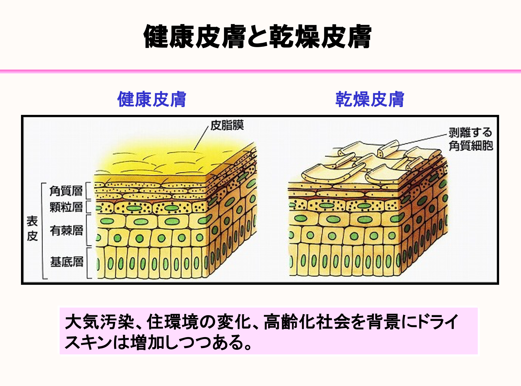 ドライスキンにおけるスキンケアの有用性