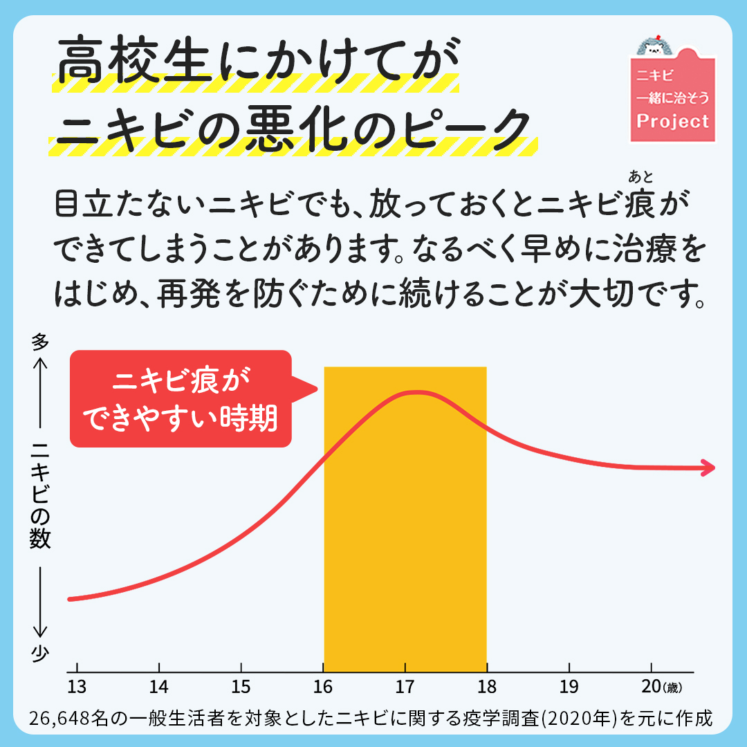 思春期用ニキビ悪化のピーク