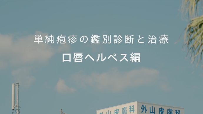 単純疱疹の鑑別診断と治療 口唇ヘルペス編