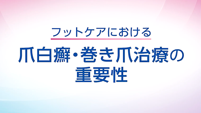 フットケアにおける爪白癬・巻き爪治療の重要性