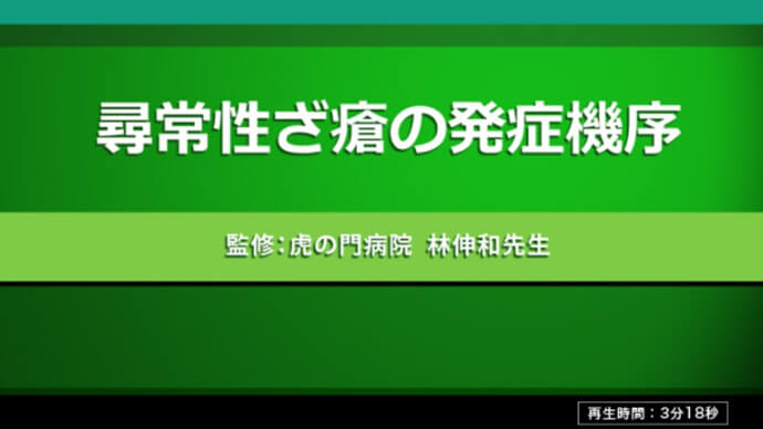 尋常性ざ瘡発症機序動画