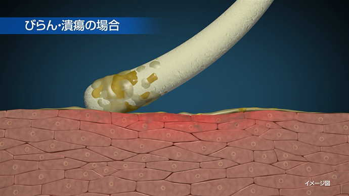 検体採取方法