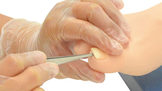 デルマクイック爪白癬の検体採取方法