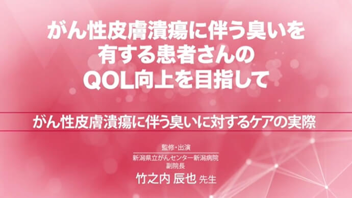 がん性皮膚潰瘍に伴う臭いに対するケアの実際