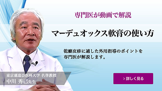 尋常性乾癬治療におけるマーデュオックス軟膏の使い方