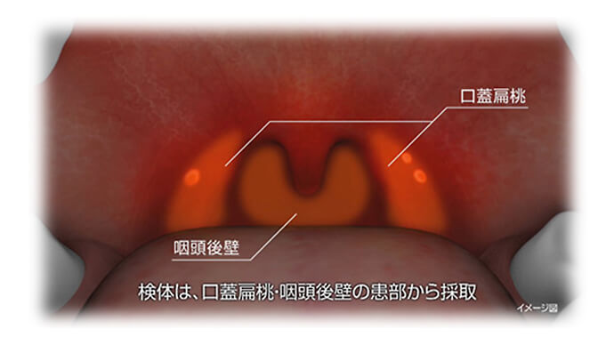 検体採取方法