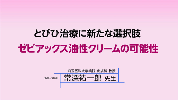 とびひ治療に新たな選択肢　ゼビアックス油性クリームの可能性