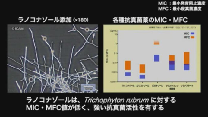 ラノコナゾールが白癬菌の増殖に与える影響