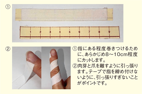 図3. テーピングの巻き方