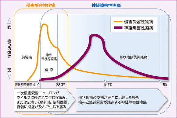 帯状疱疹関連痛の臨床経過