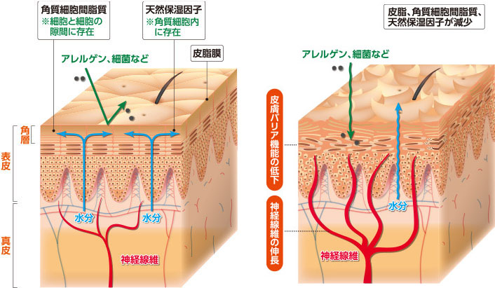 図：一般的な若年者の皮膚、一般的な高齢者の皮膚