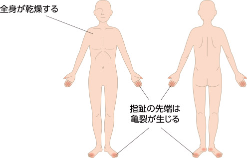 好発部位