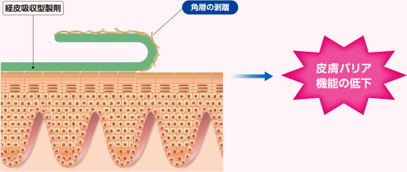 皮膚バリア機能の低下