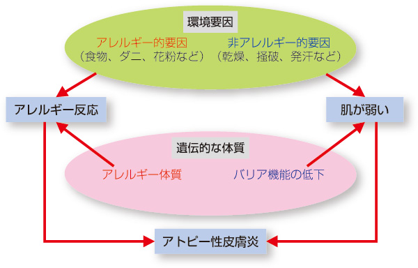 アトピー性皮膚炎の発症機序