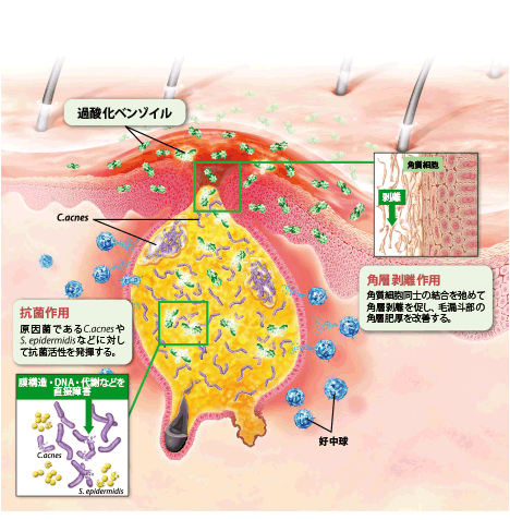 角層剥離作用