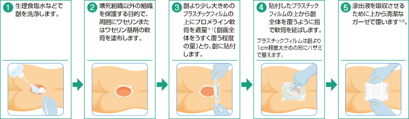 使い方