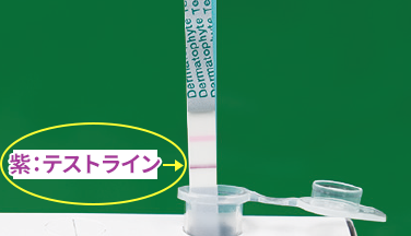 この紫⾊のテストラインが出ると⽩癬菌由来抗原陽性です。⽖⽩癬の治療を考えましょう。