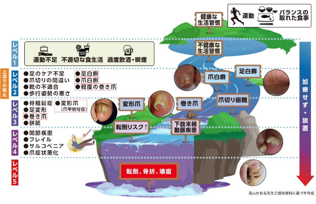 足病を放置した際の病態進行のイメージ図
