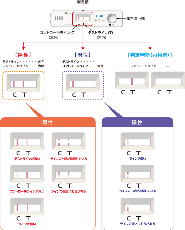 判定法