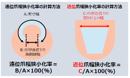 図1：  爪幅狭小化率の計算方法