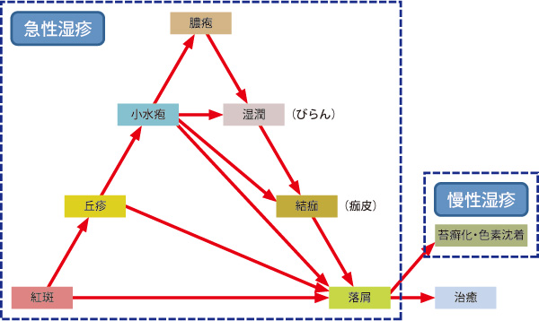 湿疹三角