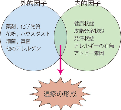 湿疹・皮膚炎の病因