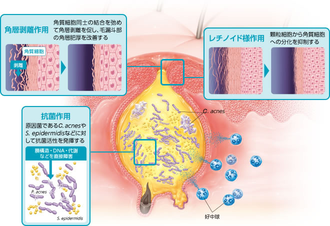 エピデュオの角層剥離作用