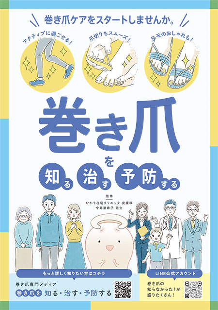 マルホ株式会社作成 巻き爪患者さん向け小冊子