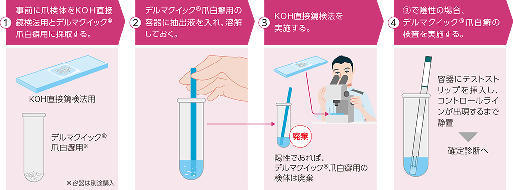 当院における爪白癬診断フロー
