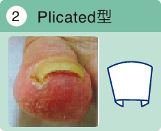Plicated型