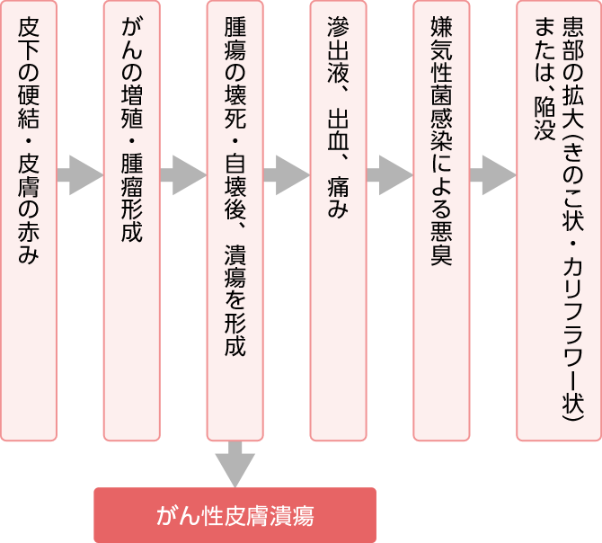 図：がん性皮膚創傷の進行過程