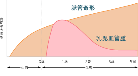 乳児血管腫と脈管奇形の経過