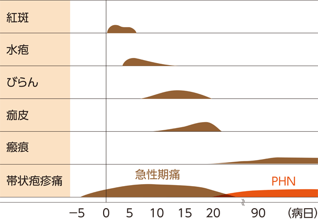 図1　皮膚症状の経過