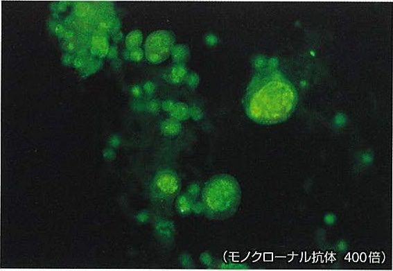 図　蛍光抗体法：ウイルス性巨細胞
