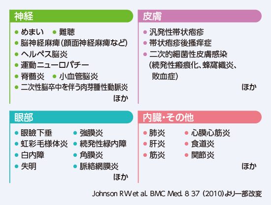 急性期から注意すべき4つの合併症（痛みを除く）