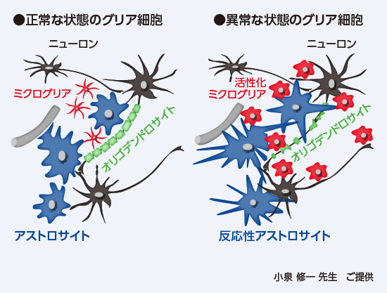 グリア細胞の変化