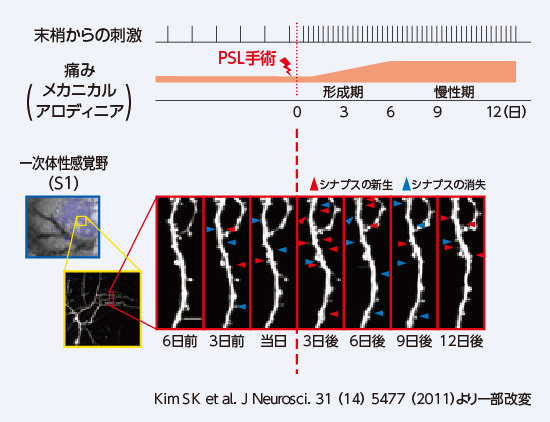 痛みの形成期におけるシナプスの再編