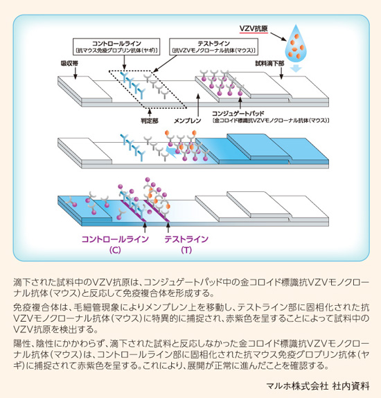 デルマクイックVZVの測定原理