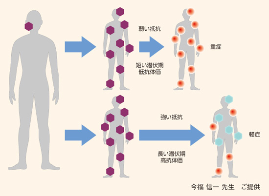 皮膚における抵抗と帯状疱疹の出現時期、重症度との関係
