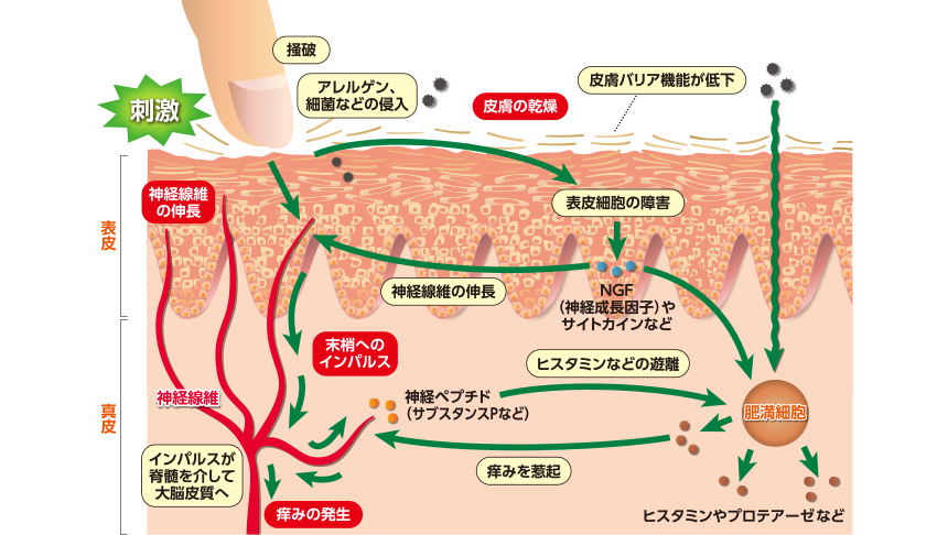 乾燥皮膚における痒みの発生機序