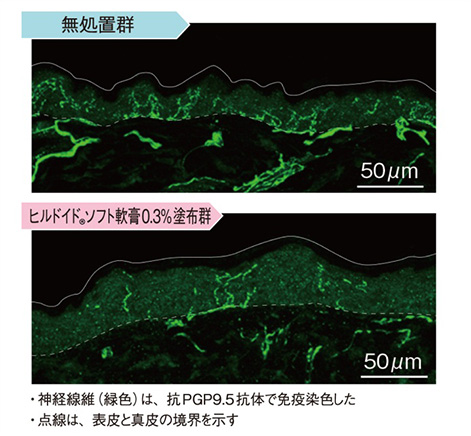 表皮内神経線維の免疫染色