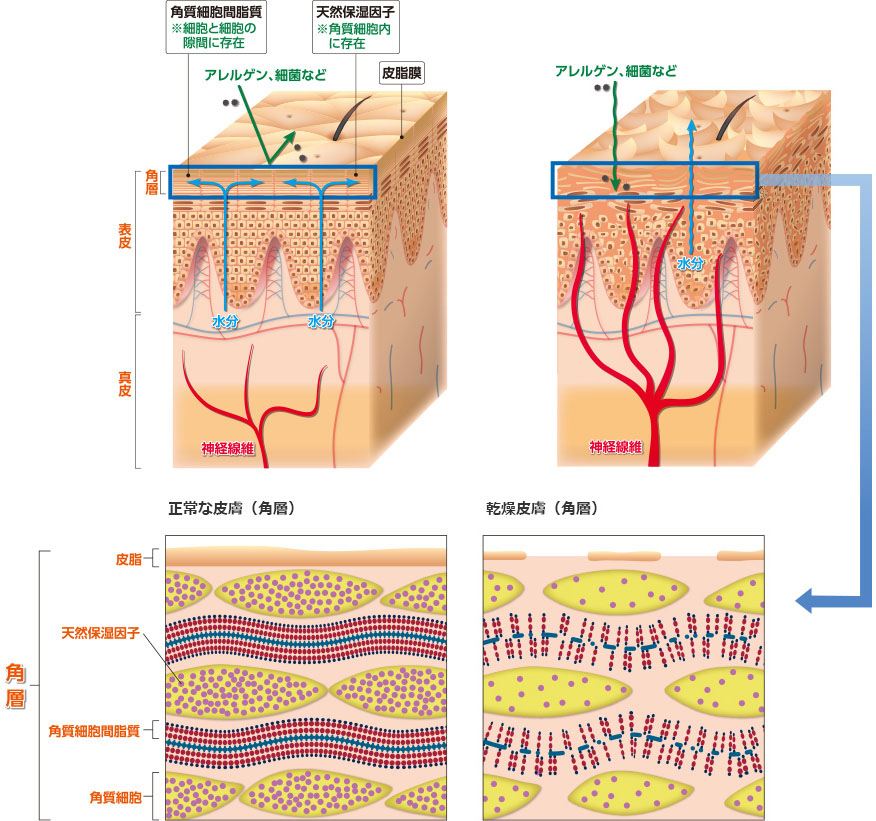 図1：正常な皮膚、図2：乾燥皮膚（ドライスキン）