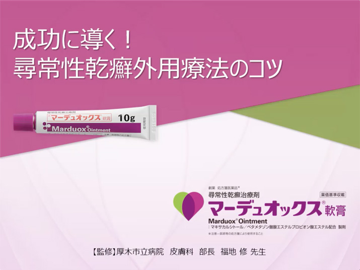 成功に導く！尋常性乾癬外用療法のコツ